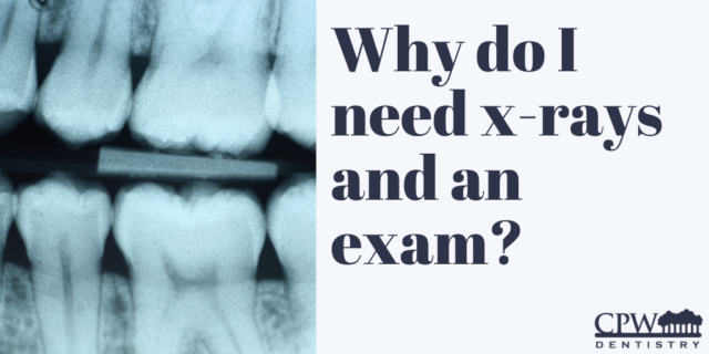 Why do I need x-rays and an exam