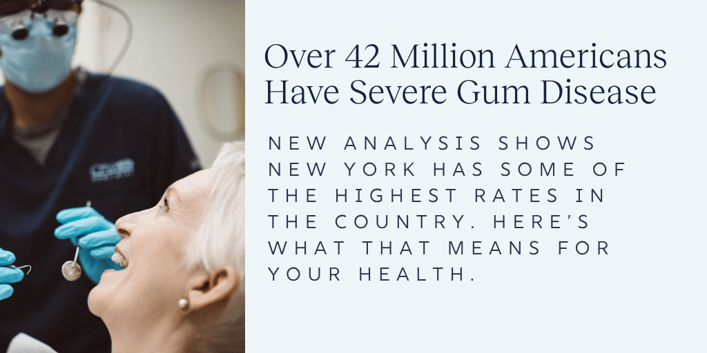 Severe Gum Disease
